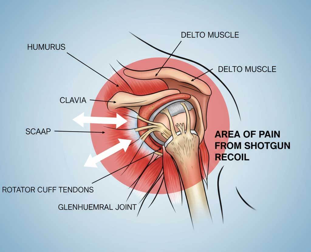 anatomy shoulder from recoil bruising